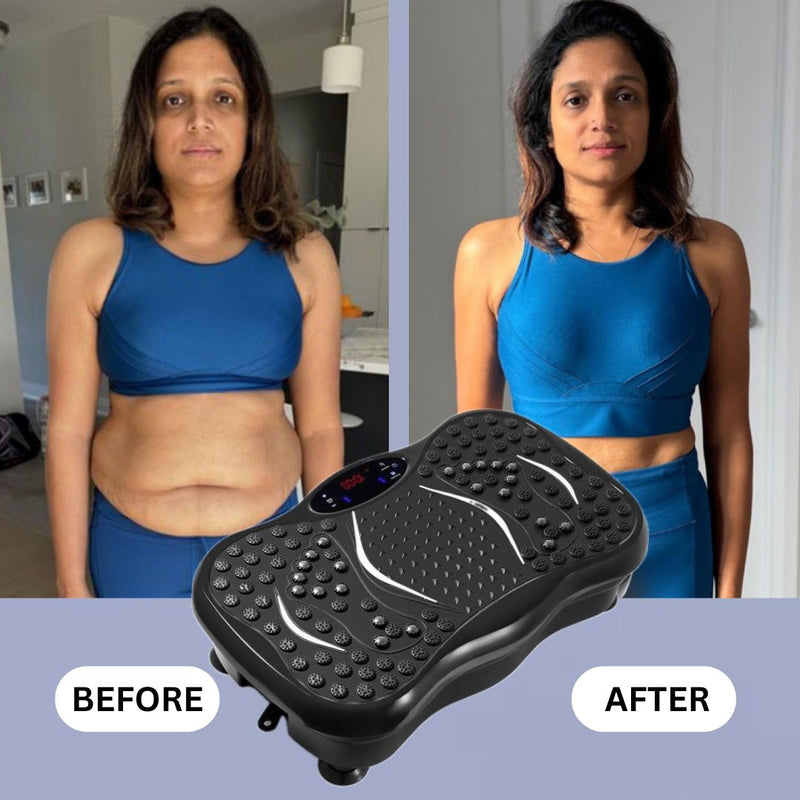 Upyogaa Vibration Plate | Fitness Platform Exercise Machine | Vibrating Lymphatic Drainage Shaking | Full Body Shaker Workout Vibrate Stand Shake Board | Sport Gym for Weight Loss Fat Burner for Women Men